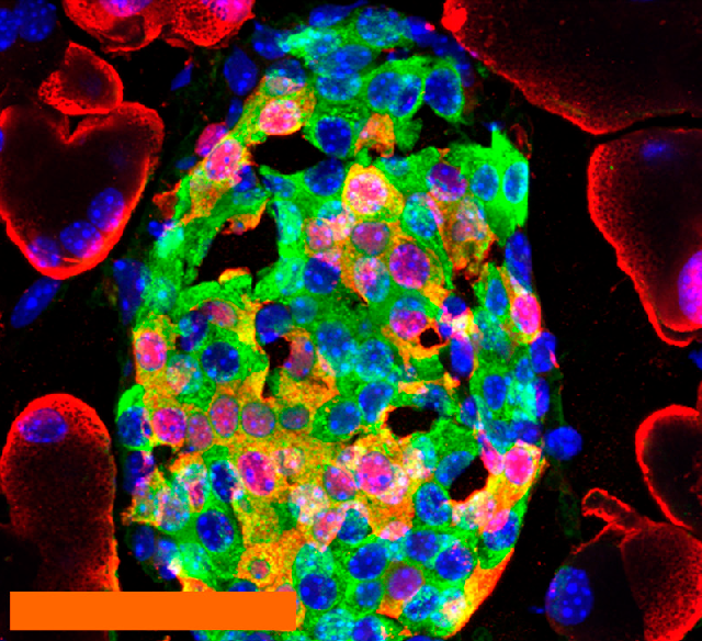 Fluorescent microscopy image of adult vascular-associated cellular labeling suggesting transdifferentiation and endothelial-associated precursor activity